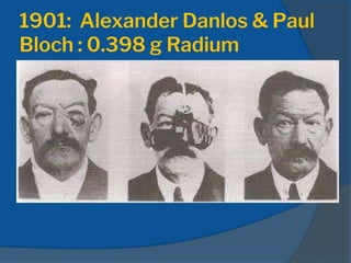 1901: Alexander Danlos & Paul
Bloch : 0.398 g Radium
 