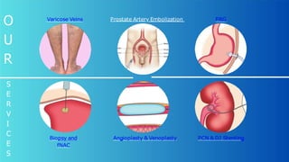 Varicose Veins Prostate Artery Embolization PRG
Biopsy and
fNAC
Angioplasty & Venoplasty PCN & DJ Stenting
O
U
R
S
E
R
V
I
C
E
S