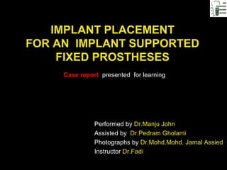 IMPLANT PLACEMENT
FOR AN IMPLANT SUPPORTED
FIXED PROSTHESES
Case report presented for learning
Performed by Dr.Manju John
Assisted by Dr.Pedram Gholami
Photographs by Dr.Mohd.Mohd. Jamal Assied
Instructor Dr.Fadi
 