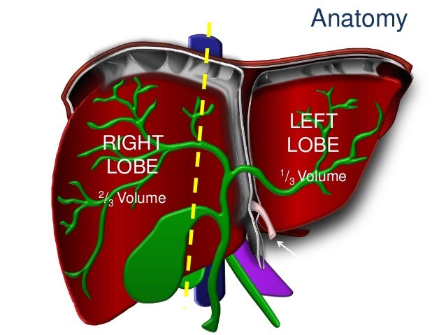 Ocular Melanoma and Liver Metastases