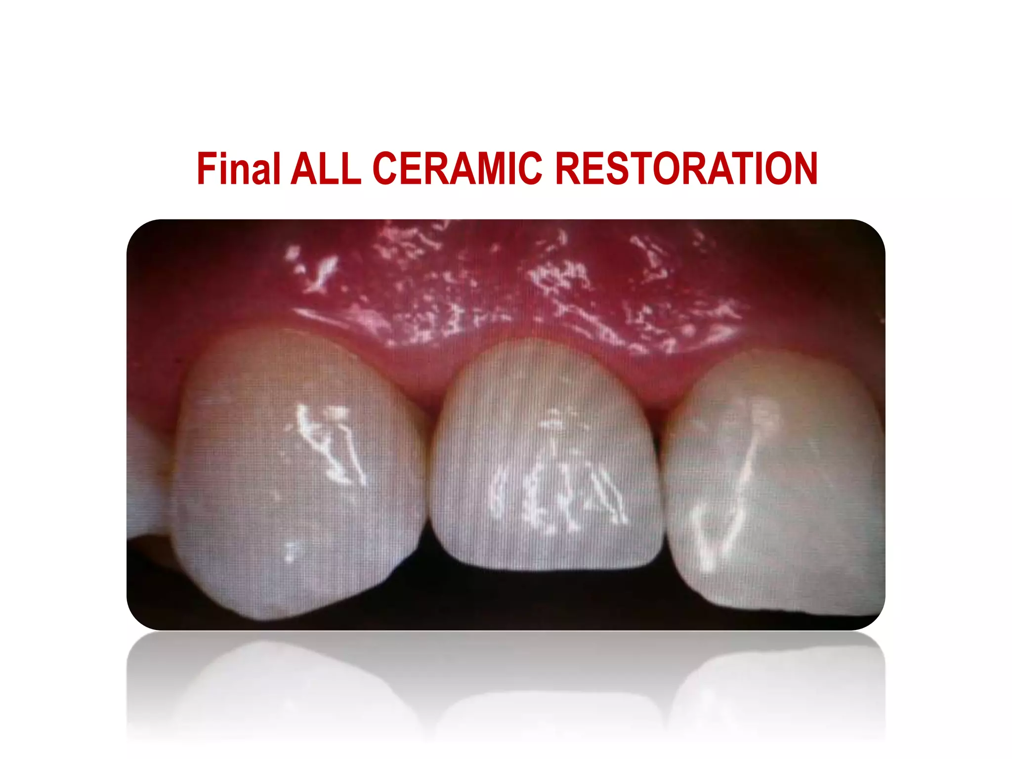 APPLICATIONS OF CERAMICS IN DENTISTRY - Dr MEENU MERRY C PAUL | PPTX