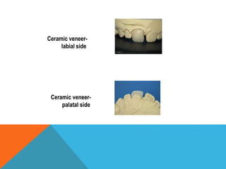 INTRODUCTION TO FIXED PARTIAL DENTURES-Dr MEENU MERRY C PAUL | PPTX