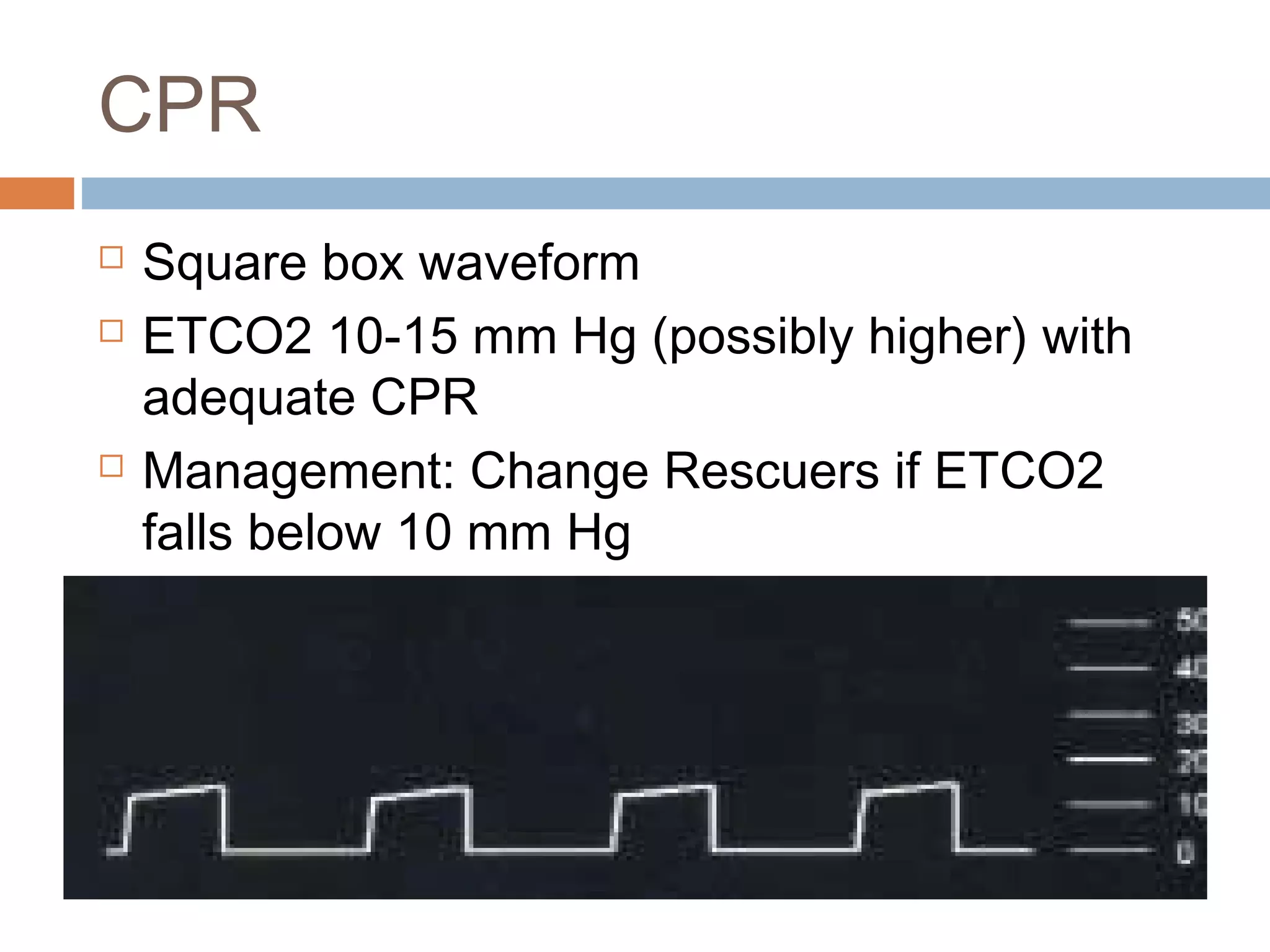 Etco2 in non-intubated patient: a must in ed | PPT