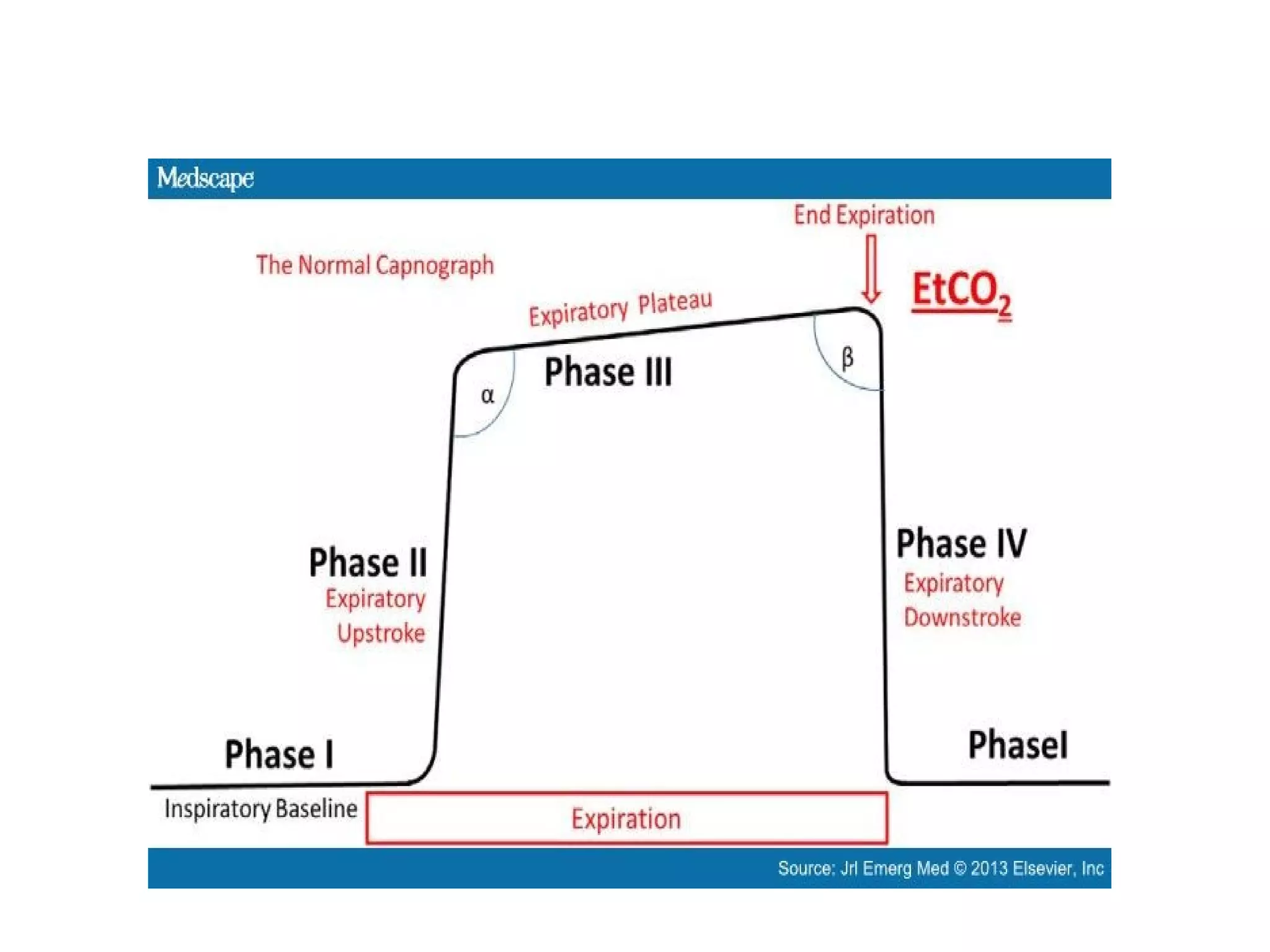 Etco2 in non-intubated patient: a must in ed | PPT