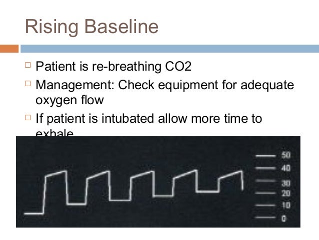 Etco2 in non-intubated patient: a must in ed