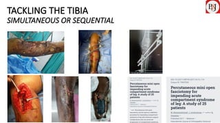 COMPARTMENT SYNDROME IN TIBIAL FRACTURES AND PERCUTANEOUS MINI OPEN ...