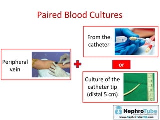 Paired Blood Cultures
Peripheral
vein
From the
catheter
Culture of the
catheter tip
(distal 5 cm)
or
 