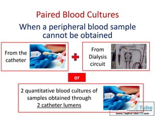 Paired Blood Cultures
or
When a peripheral blood sample
cannot be obtained
From the
catheter
From
Dialysis
circuit
2 quantitative blood cultures of
samples obtained through
2 catheter lumens
 