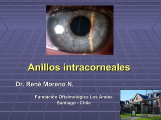Anillos intracornealesAnillos intracorneales
Dr. René Moreno N.Dr. René Moreno N.
Fundación Oftalmológica Los AndesFundación Oftalmológica Los Andes
Santiago - ChileSantiago - Chile
 