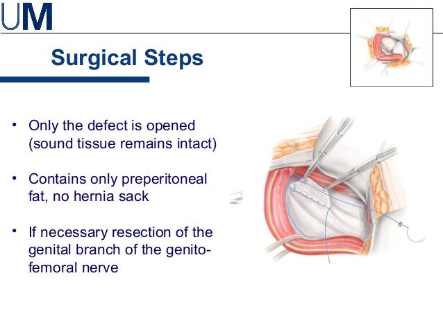 hernie-incisionnelle-pdf-chirurgie-d-une-ventration-ou-hernie