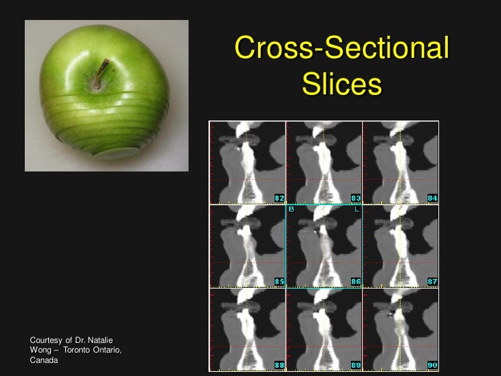 Simplant Viewer For Mac