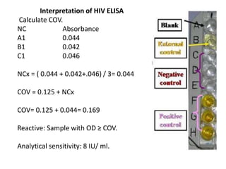 Interpretation of HIV ELISA
Calculate COV.
NC Absorbance
A1 0.044
B1 0.042
C1 0.046
NCx = ( 0.044 + 0.042+.046) / 3= 0.044
COV = 0.125 + NCx
COV= 0.125 + 0.044= 0.169
Reactive: Sample with OD ≥ COV.
Analytical sensitivity: 8 IU/ ml.
 