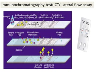 Immunochromatography test(ICT/ Lateral flow assay
 