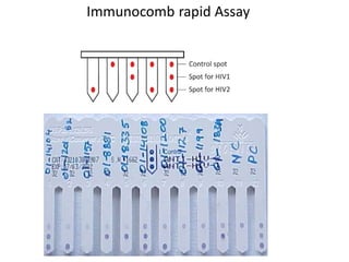 Immunocomb rapid Assay
 