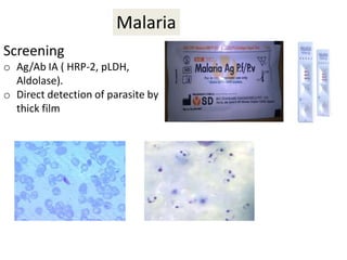 Malaria
Screening
o Ag/Ab IA ( HRP-2, pLDH,
Aldolase).
o Direct detection of parasite by
thick film
 