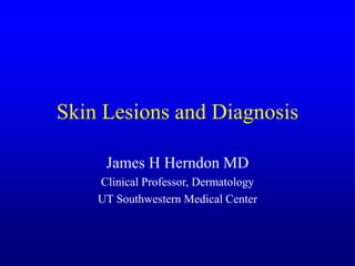 Skin Lesions and Diagnosis
James H Herndon MD
Clinical Professor, Dermatology
UT Southwestern Medical Center
 