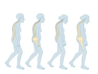 Bone Health, Falls Prevention and Falls Reduction Strategies - AIGNA ...