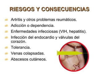 RIESGOS Y CONSECUENCIAS Artritis y otros problemas reumáticos. Adicción o dependencia. Enfermedades infecciosas (VIH, hepatitis). Infección del endocardio y válvulas del corazón. Tolerancia. Venas colapsadas. Abscesos cutáneos. 