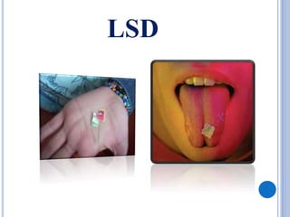 LSD
 