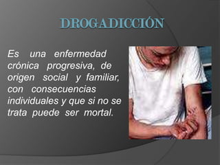 DROGADICCIÓN Es    una   enfermedad crónica   progresiva,  de origen   social   y  familiar,    con   consecuencias individuales y que si no se trata  puede  ser  mortal. 