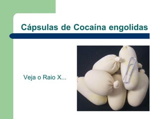 Cápsulas   de   Cocaína   engolidas   Veja o Raio X... 