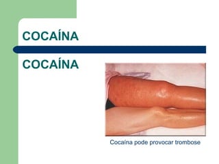 COCAÍNA  COCAÍNA  Cocaína pode provocar trombose 