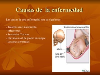 Causas de la enfermedad
Las causas de esta enfermedad son las siguientes:

- Traumas en el nacimiento
- Infecciones
- Sustancias Toxicas
- Elevado nivel de plomo en sangre
- Lesiones cerebrales
 
