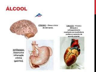 ÁLCOOL
 
