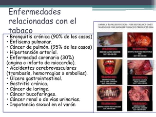 Enfermedades
relacionadas con el
tabaco
• Bronquitis crónica (90% de los casos) .
• Enfisema pulmonar.
• Cáncer de pulmón. (95% de los casos)
• Hipertensión arterial.
• Enfermedad coronaria (30%)
(angina o infarto de miocardio).
• Accidentes cerebrovasculares
(trombosis, hemorragias o embolias).
• Úlcera gastrointestinal.
• Gastritis crónica.
• Cáncer de laringe.
• Cáncer bucofaríngeo.
• Cáncer renal o de vías urinarias.
• Impotencia sexual en el varón
 