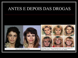 ANTES E DEPOIS DAS DROGAS 
 