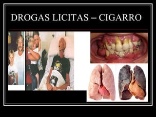 DROGAS LICITAS – CIGARRO 
 