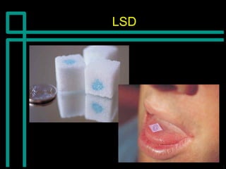 LSDLSD
 