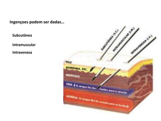 Ingençoes podem ser dadas…
Subcutânea
Intramuscular
Intravenosa
 