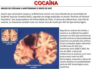 COCAÍNA
ABUSO DE COCAINA E ANFETAMINAS E RISCO DE AVC
Jovens que consomem cocaína e anfetaminas correm um risco elevado de ser acometido de
Acidente Vascular Cerebral (AVC), segundo um artigo publicado na revista “Archives of General
Psychiatry” por pesquisadores da Universidade do Texas. O abuso de anfetaminas, mas não de
cocaína, se relacionou também com um maior risco de morte por AVC do tipo hemorrágico.
Segundo os autores do estudo, a
cocaína e as anfetaminas podem
provocar um AVC pelo aumento da
pressão arterial ou desencadeando
espasmos nas paredes das artérias.
Foram analisados dados referentes
a 8.369 casos de AVC que
ocorreram entre 2000 e 2003. No
ano de 2003, o abuso de
anfetaminas se associou a um risco
quatro vezes maior de AVC
hemorrágico, enquanto o abuso de
cocaína duplicou as probabilidades
tanto de AVC hemorrágico como
isquêmico.
 