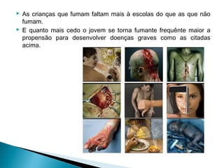  As crianças que fumam faltam mais à escolas do que as que não
  fumam.
 E quanto mais cedo o jovem se torna fumante frequênte maior a
  propensão para desenvolver doenças graves como as citadas
  acima.
 