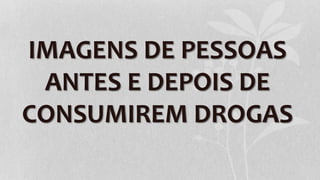 IMAGENS DE PESSOAS 
ANTES E DEPOIS DE 
CONSUMIREM DROGAS 
 