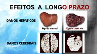 EFEITOS A LONGO PRAZO 
Fígado normal Fígado cirrótico 
DANOS HEPÁTICOS 
DANOS CEREBRAIS 
 