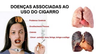 DOENÇAS ASSOCIADAS AO 
USO DO CIGARRO 
 