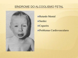 SÍNDROME DO ALCOOLISMO FETAL
Retardo Mental
Surdez
Cegueira
Problemas Cardiovasculares
 