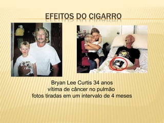 EFEITOS DO CIGARRO
Bryan Lee Curtis 34 anos
vítima de câncer no pulmão
fotos tiradas em um intervalo de 4 meses
 