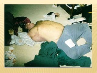 ESTUDO DE CASO: CHRIS FARLEY
Christopher Crosby Farley
Nascimento: 15 de fevereiro
de 1964
Usuário de drogas e alcóolatra
Morreu de overdose em 18 de
dezembro de 1997
 