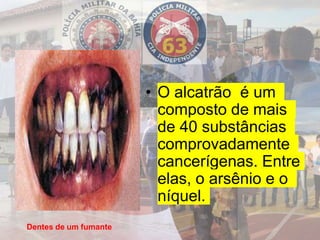 • O alcatrão é um
composto de mais
de 40 substâncias
comprovadamente
cancerígenas. Entre
elas, o arsênio e o
níquel.
Dentes de um fumante
 