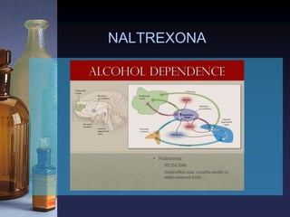 NALTREXONA
 
