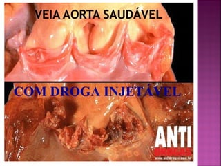 COM DROGA INJETÁVEL
 