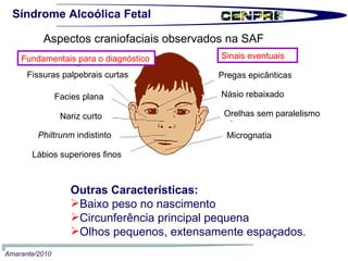 Síndrome Alcoólica Fetal Outras Características: Baixo peso no nascimento Circunferência principal pequena Olhos pequenos, extensamente espaçados.  Fundamentais para o diagnóstico Fissuras palpebrais curtas Facies plana Nariz curto Philtrunm  indistinto  Lábios superiores finos Sinais eventuais Pregas epicânticas Násio rebaixado  Orelhas sem paralelismo Micrognatia  Aspectos craniofaciais observados na SAF Amarante/2010 