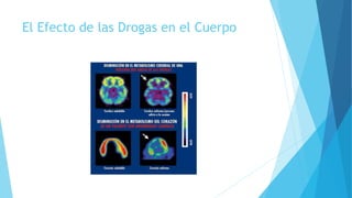 El Efecto de las Drogas en el Cuerpo
 