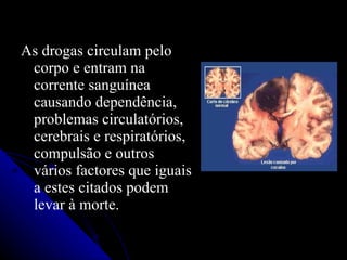 As drogas circulam pelo
 corpo e entram na
 corrente sanguínea
 causando dependência,
 problemas circulatórios,
 cerebrais e respiratórios,
 compulsão e outros
 vários factores que iguais
 a estes citados podem
 levar à morte.
 
