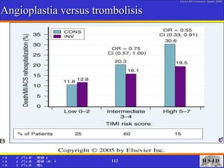 Angioplastia versus trombolisis 