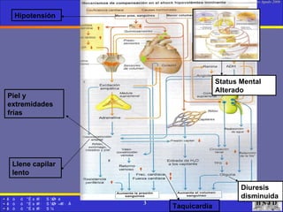 Hipotensión Taquicardia Piel y extremidades frías Llene capilar lento Diuresis disminuida Status Mental Alterado 
