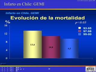 Infarto en Chile: GEMI 